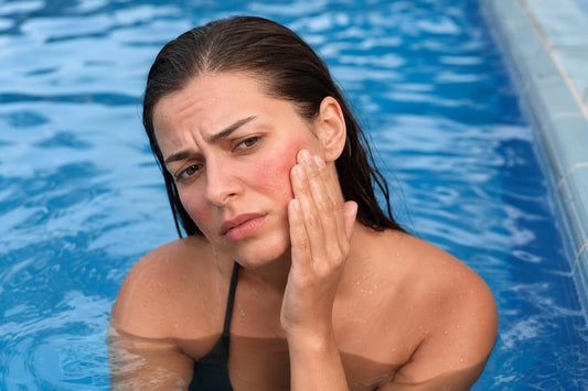 Is Chlorine Bad for Your Skin