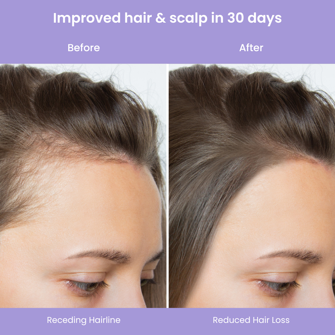 Lucinn Pro Filtered Showerhead